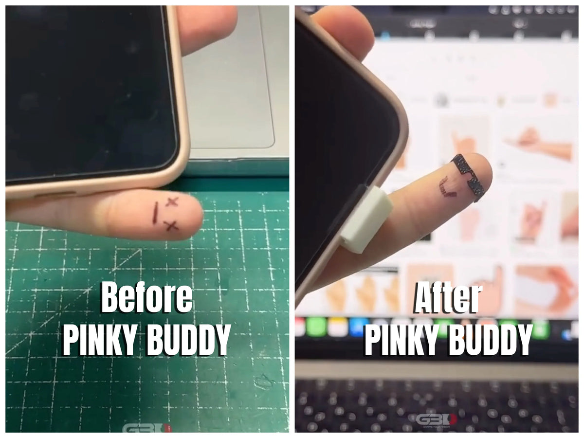 Pinky Buddy | Ergonomic Phone Grip & Fidget by G3D Printlab